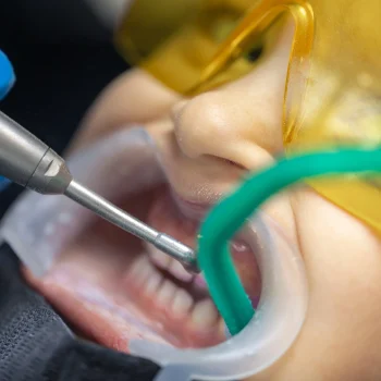 closeup-childs-mouth-dental-treatment-dentistry-dental-treatment