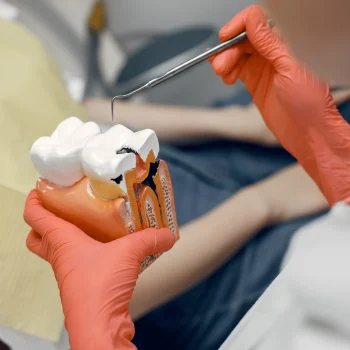 model-tooth-dentist-doctor-shows-patient-tooth-reception-dentist-s-office